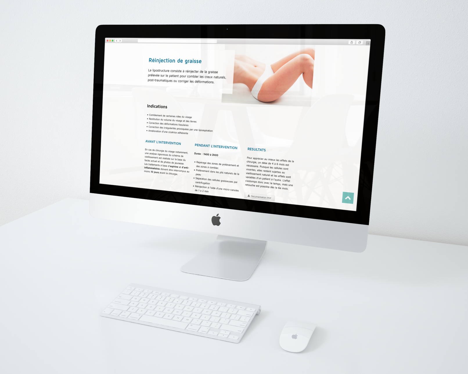 Nader Chahidi - chirurgie esthétique - lipostructure - ©wysiswyg agence web